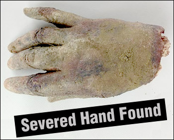 Photo of the alleged severed human hand