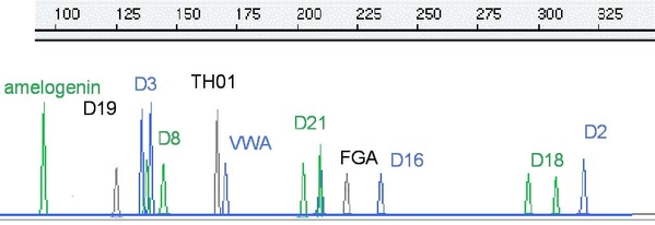 003093-71: Billie Jo Jones DNA profile