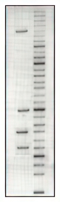 DNA gel electrophoresis
