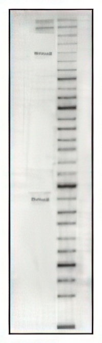 DNA gel electrophoresis