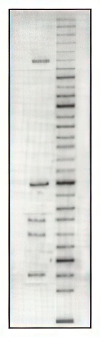DNA gel electrophoresis