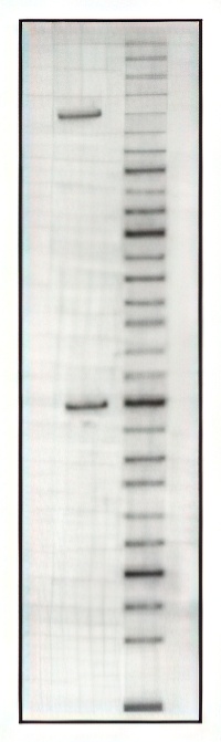 DNA gel electrophoresis