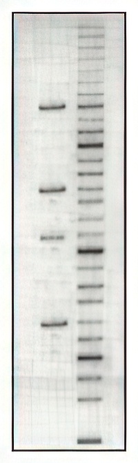 DNA gel electrophoresis