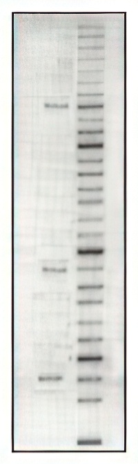 DNA gel electrophoresis