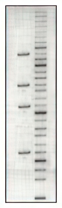 DNA gel electrophoresis
