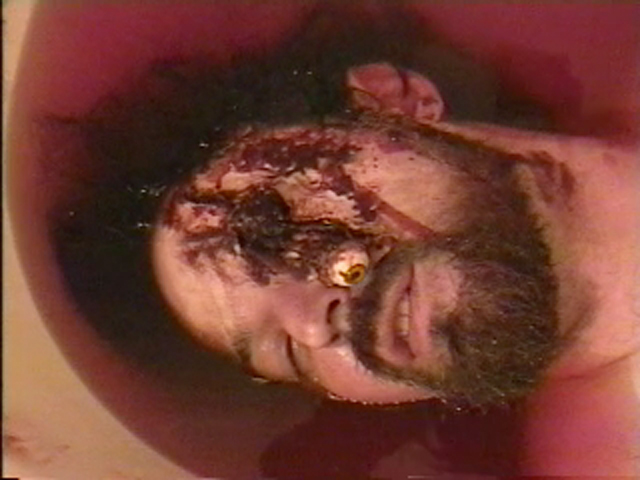 Close view of Male murder victim with bludgeoned face.