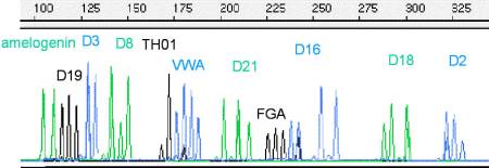 Electropherogram 003419-04-02D