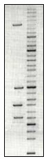 DNA gel electrophoresis