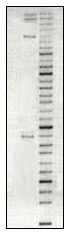 DNA gel electrophoresis