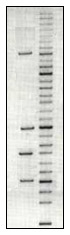 DNA gel electrophoresis