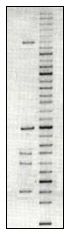 DNA gel electrophoresis