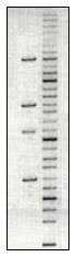 DNA gel electrophoresis