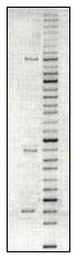 DNA gel electrophoresis