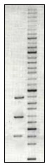 DNA gel electrophoresis