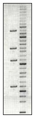 DNA gel electrophoresis