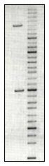 DNA gel electrophoresis