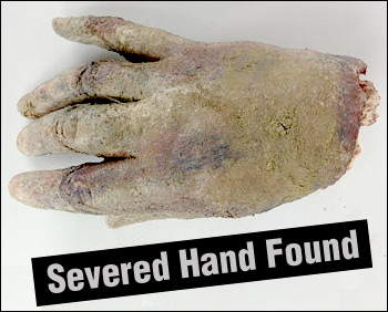Photo of the alleged severed human hand