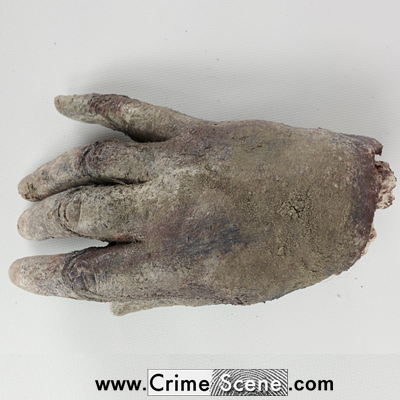 Drunken farmer arrested after brandishing severed hand Drunken farmer arrested after brandishing severed hand