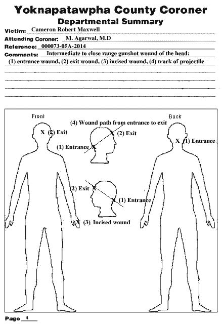 Coroner's Diagram of Cameron Maxwell's injuries