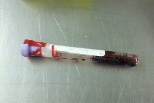 A picture of some blood droplets.