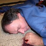 closeup of a dead body with blood pooling from underneath the hand.