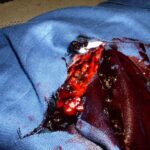 Picture of an open wound from a dead body