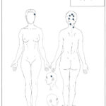 A drawing of a womans body with dots that point to damage on the body.