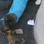 a picture of a leg taken near a dumpster.