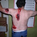a picture of a man with his back turned towards the camera with blood wounds on his back.