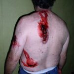 a picture of a man with his back turned towards the camera with blood wounds on his back.