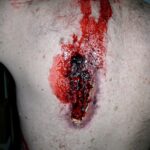 a closeup picture of a man with bloody wounds on his back