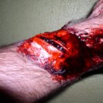 a closeup of a wound on a man's arm
