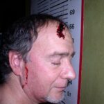 a picture of a man with blood streaming down his ear
