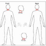 A picture of a diagram showing an illustration of someone with a rope around his neck