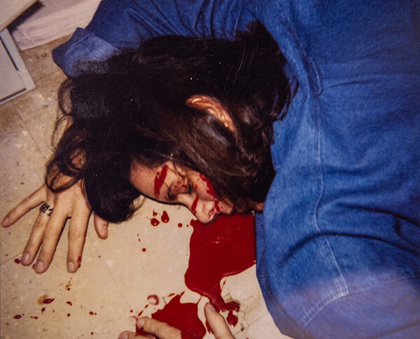A picture of a body with blood pooling from under the head.