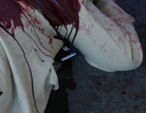 Torso and right arm of person in a prone position wearing a yellow suit covered in blood. Note under the right arm is exposed.