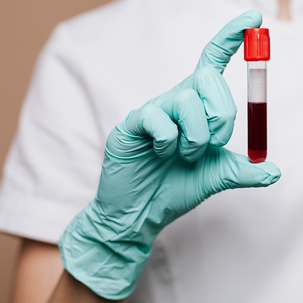 Gloved hand holding a vial of blood